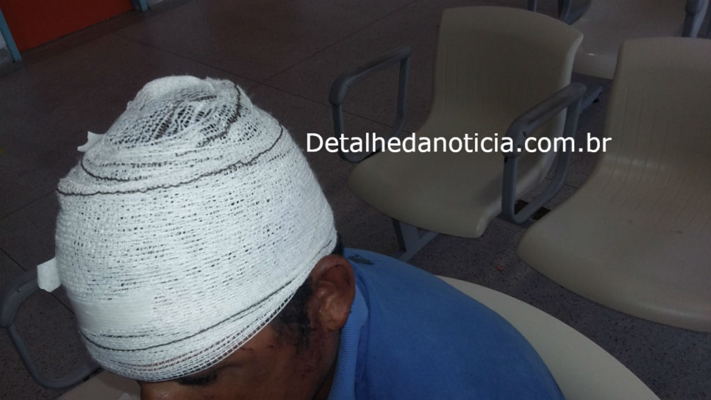 Áudio:detalhedanoticia entrevista homem agredido pelo irmão com cabo de picareta